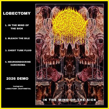 Lobectomy - In the Mind of the Sick (2026)