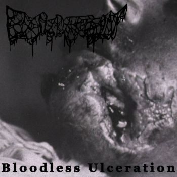 Exsudation - Bloodless Ulceration (2026)