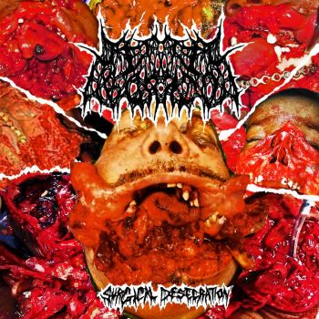 Septic Abortion - Surgical Desecration (2026)
