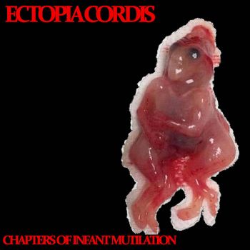 Ectopia Cordis - Chapters of Infant Mutilation (2023)