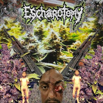 Escharotomy - Escharotomy (2026)