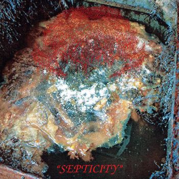 Fosse Septique - Septicity (2026)