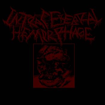 Intracerebral Hemorrhage - Intracerebral Hemorrhage (2026)