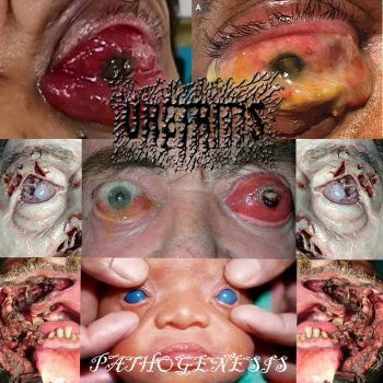 Uretritis - Pathogenesis (2026)