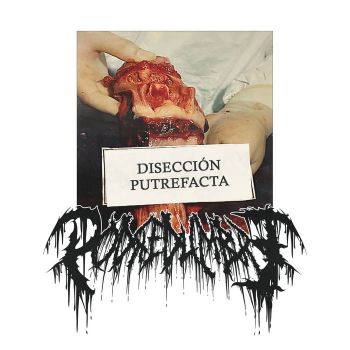 Podredumbre - Diseccion Putrefacta (2025)