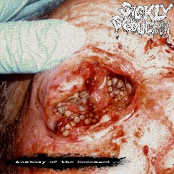 Sickly Seduction - Anatomy of the Deceased (2026)