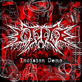 Injected - Incision Demo (2026)