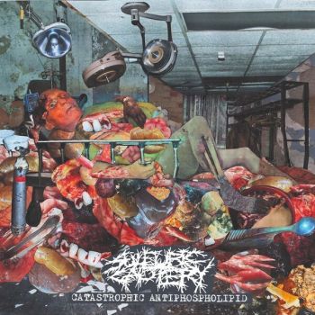 Sulfuric Cautery - Catastrophic Antiphospholipid (2026)