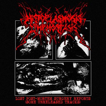 Histoplasmosislymphostasis - Lost Post-Mortem Surgery Reports (Some Unreleased Tracks) (2026)