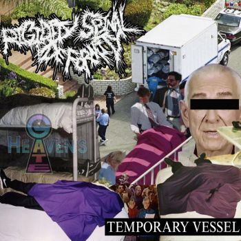 Rigidity Spinal Deformity - Temporary Vessel (2026)