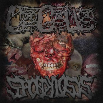 Spondylosys - Accumulation of Putrescent Organic Matter (2026)