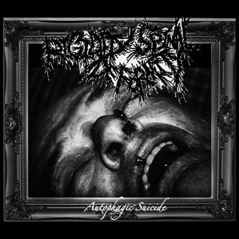 Rigidity Spinal Deformity - Autophagic Suicide (2025)