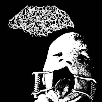 Rupture of the Gastrointestinal Tract - Dolcett (2026)