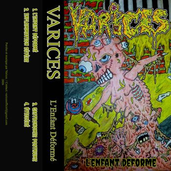 Varices - L'Enfant Deforme (2026)
